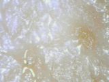 �}�C�N���X�R�[�v�Ō��������̃L��