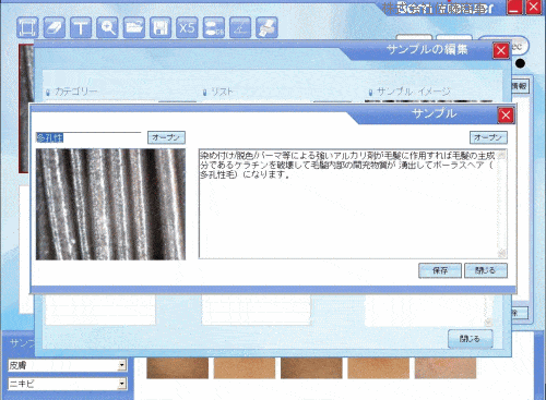 ���e�}�C�N���X�R�[�v�V�X�e��K