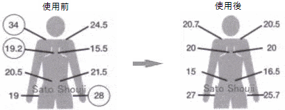 筋硬度計肩こり測定器