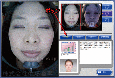 ウッドランプ肌解析機