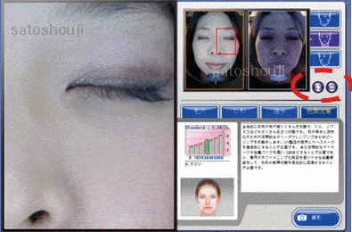 ウッドランプ肌解析機