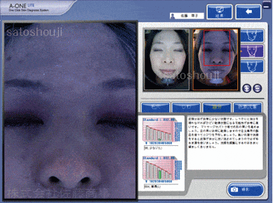 ウッドランプ肌解析機